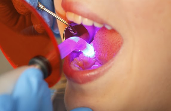 teeth whitening panoramic dental
